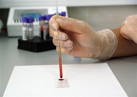 red drop blood cancer test|blood test for cancer treatment.